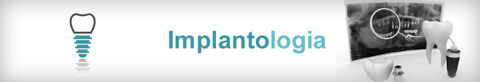 Implantologia