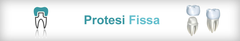 Protesi Fissa